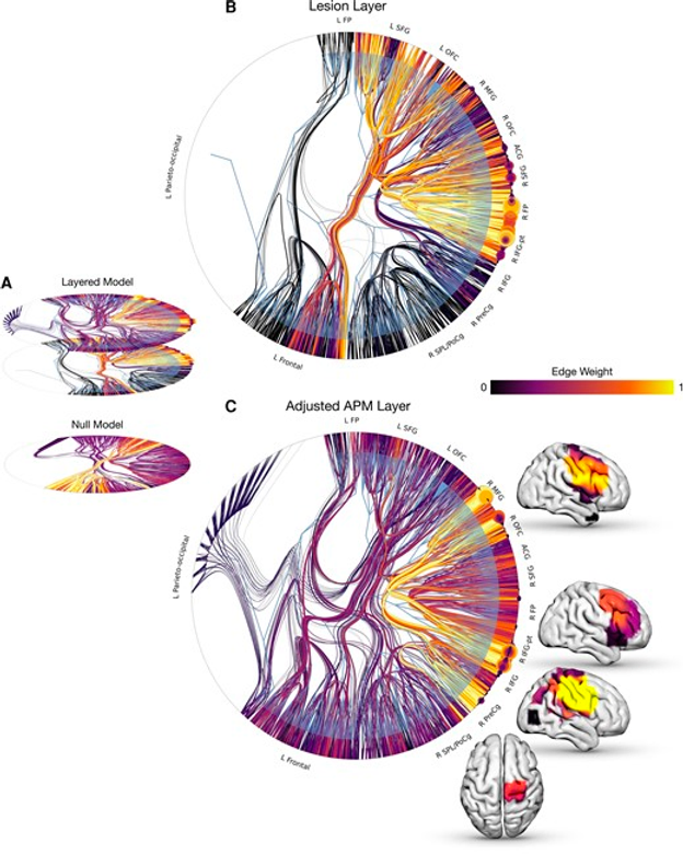 Generative stochastic block models of fluid intelligence. Radial graphs of stochastic block models with adjusted APM and lesion co-occurrence layered (top), versus randomly distributed across layers (bottom).