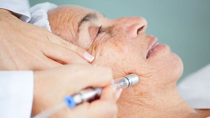 Nobalspece Injection New nanoparticle injection kills skin cancer - The Brighter Side of News