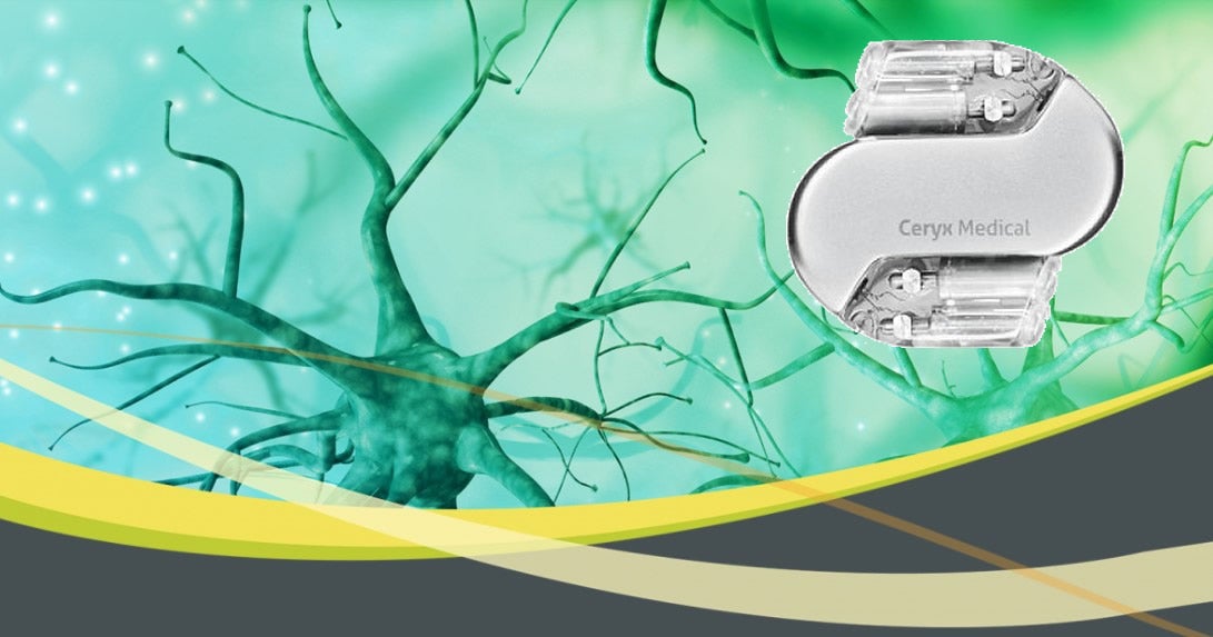 'Bionic' pacemaker reverses heart failure - The Brighter Side of News