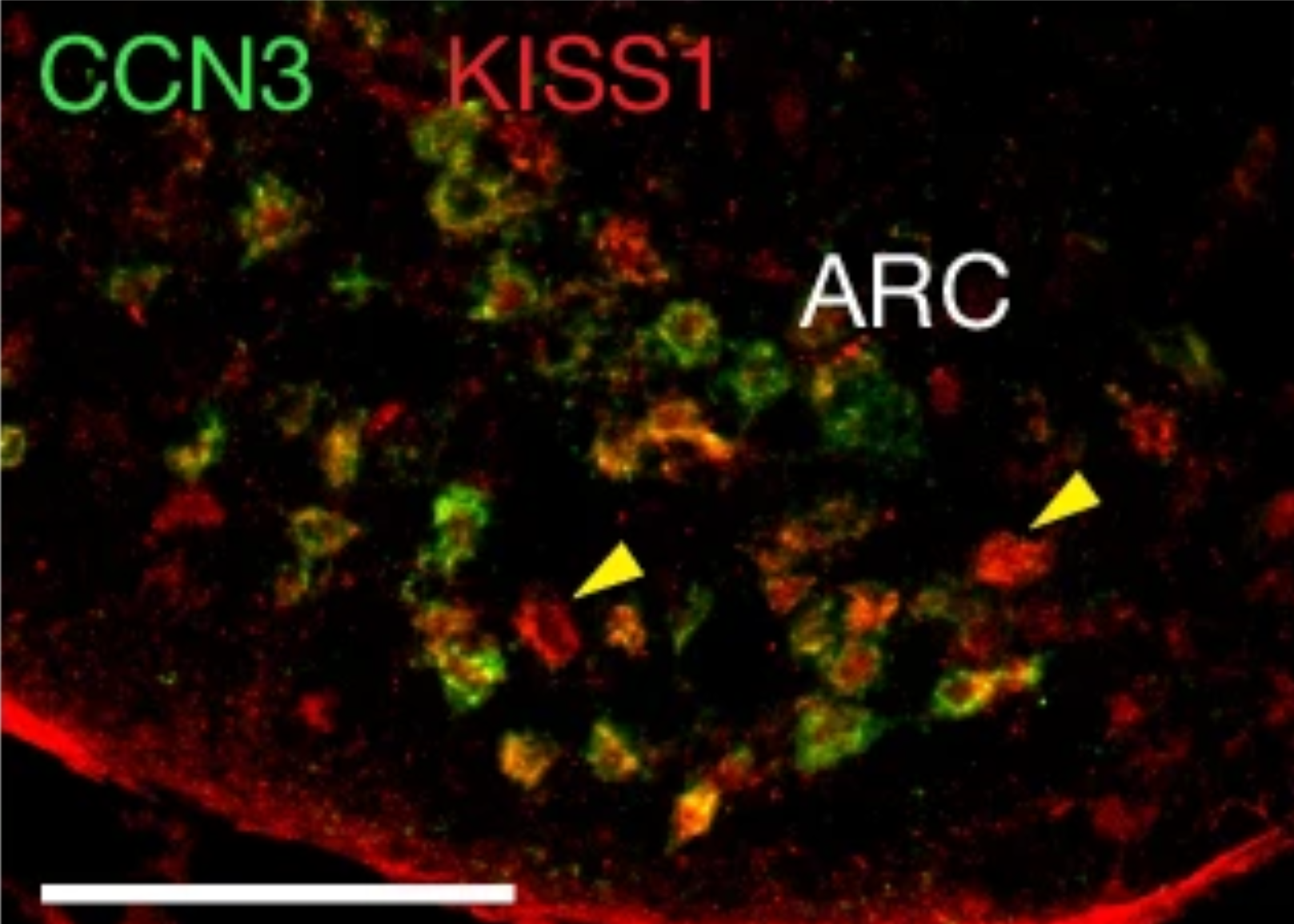 Identification of CCN3 as a brain-derived osteoanabolic factor.
