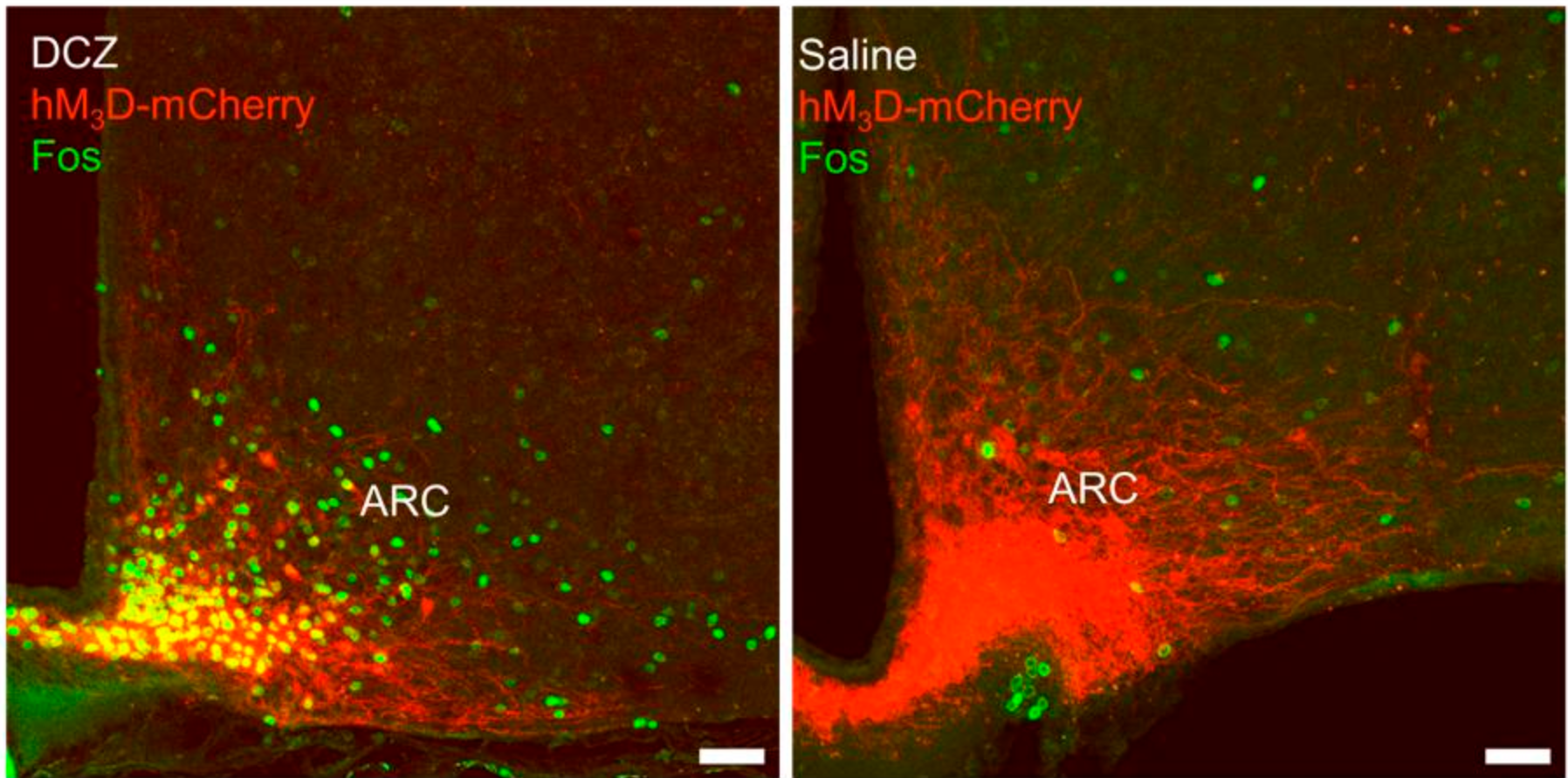  AAV-mediated functional expression of hM3Dq-mCherry in AgRP neurons after DCZ (0.3 mg/kg) or saline treatment. Representative confocal images are shown after staining for c-Fos.