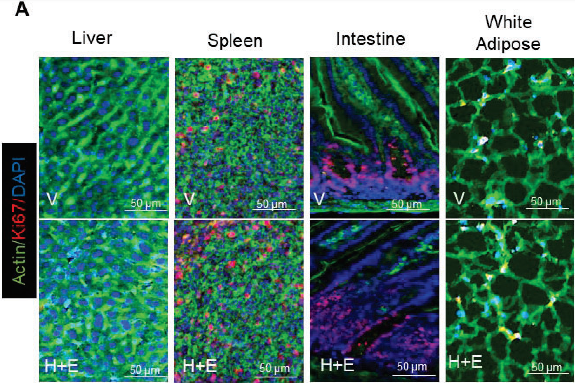 Following three months of treatment, Ki67 immunolabeling was assessed and quantified in mouse liver, spleen, intestine, white adipose tissue, lung, heart, kidney, and pancreas. 