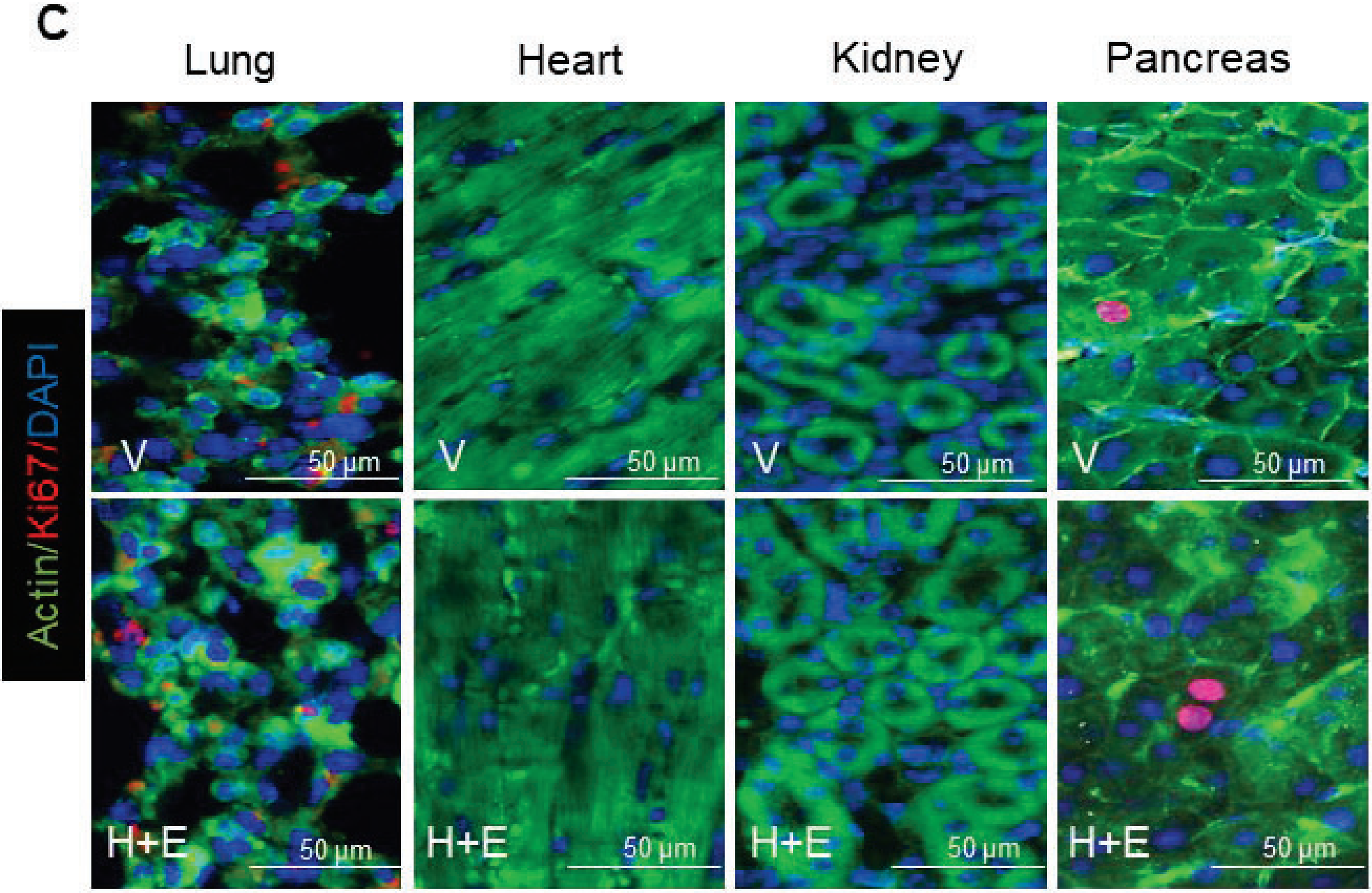 Following three months of treatment, Ki67 immunolabeling was assessed and quantified in mouse liver, spleen, intestine, white adipose tissue, lung, heart, kidney, and pancreas. 