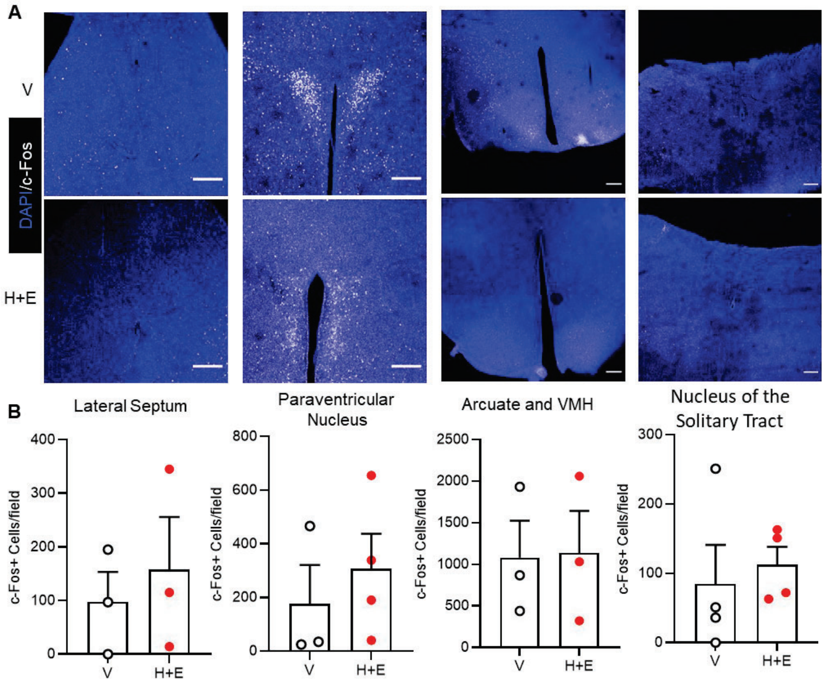 Brains from a subset of the same groups of mice were harvested. (A) and (B), cells in CNS nuclei known to have GLP1 receptors (lateral septum, paraventricular nucleus, arcuate, ventromedial hypothalamus, nucleus of the solitary tract) were examined for c-Fos activation.