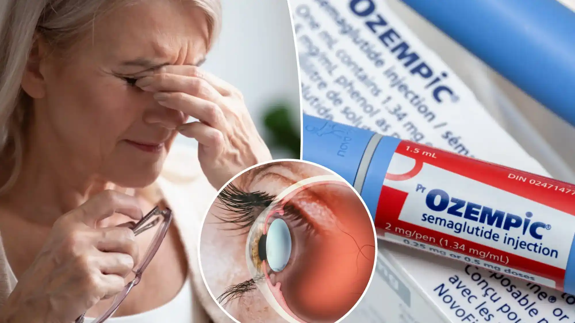 Study reveals potential eye risk for Semaglutide (Ozempic) users