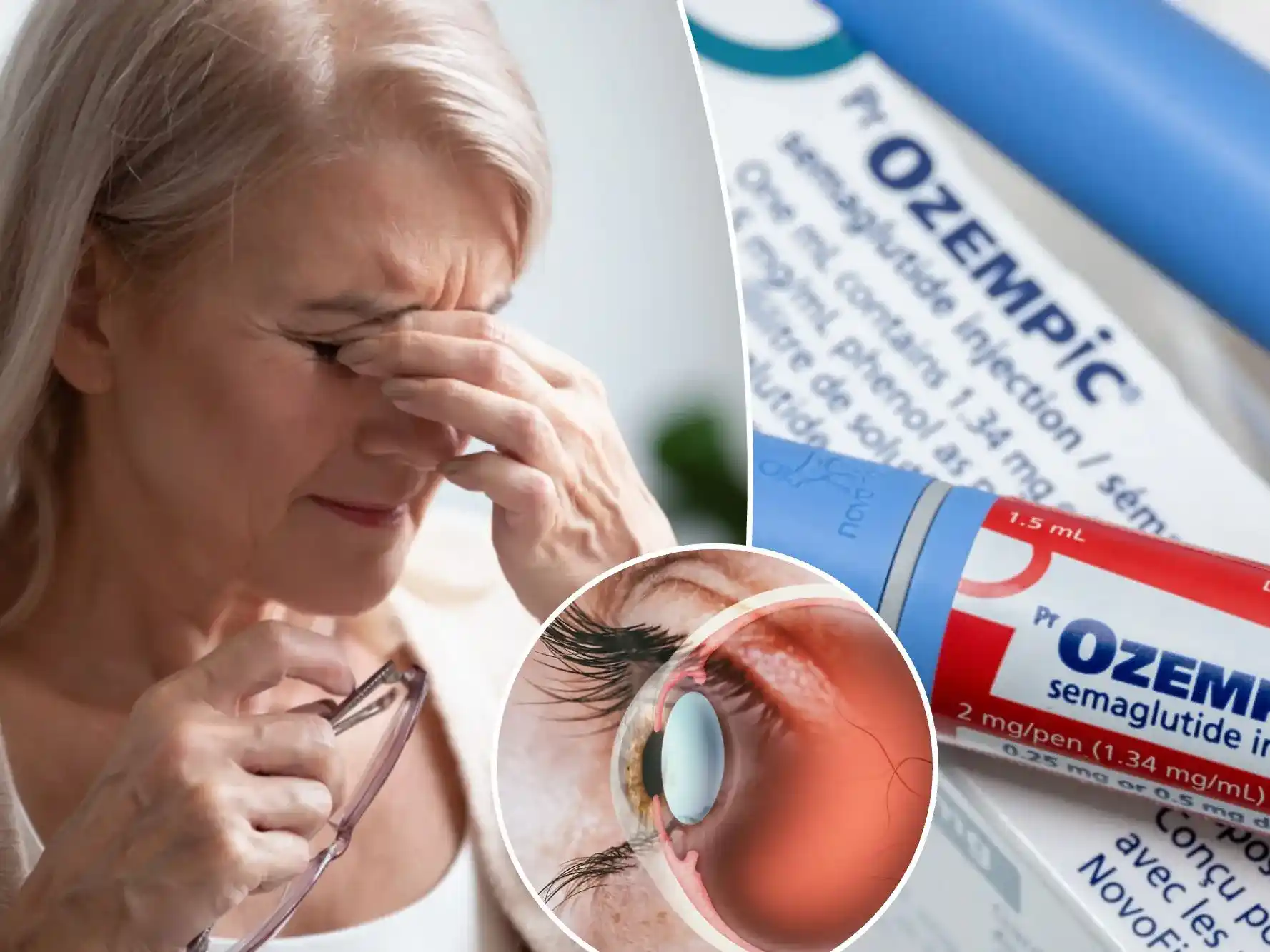 Study reveals potential eye risk for Semaglutide (Ozempic) users