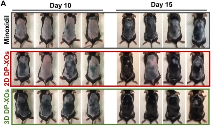 Effects of exosome treatment on dorsal hair regrowth. (A) Mice were divided into three groups (n = 4) and treated on their left sides. Mice were imaged on days 10 and 15, respectively.