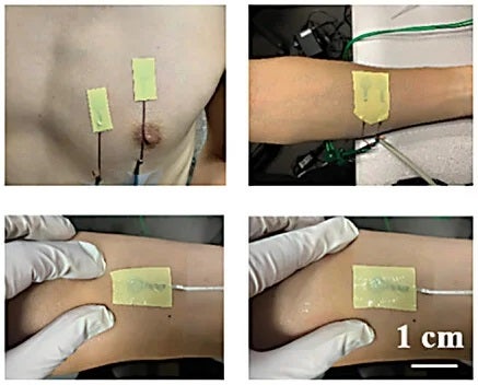 Biopotential Monitoring.