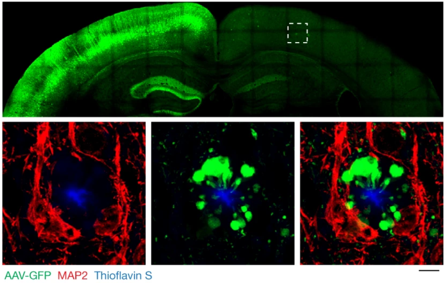 Plaque-associated axonal spheroids block AP propagation and disrupt interhemispheric connectivity.