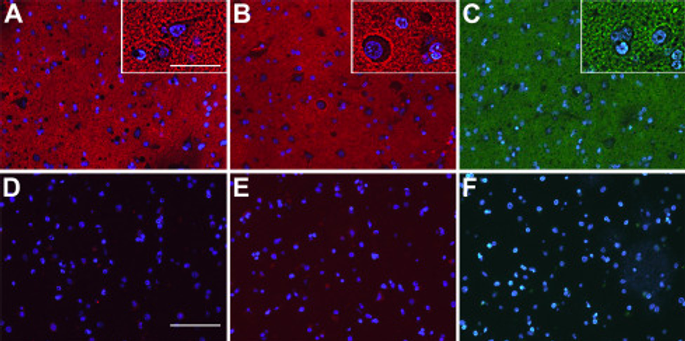 Le ligand CD33/Siglec-8 du cerveau humain est distribué dans tout le parenchyme du cortex cérébral. (CRÉDIT : Journal of Biological Chemistry)