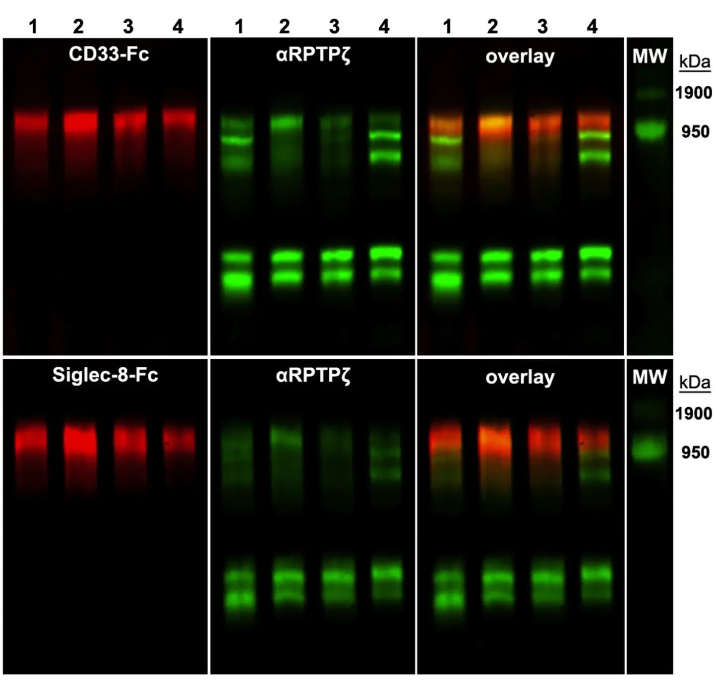 La même glycoforme de RPTPζ porte les ligands CD33 et Siglec-8. A, des aliquotes égales d'extrait protéique total du cortex cérébral humain provenant de quatre donneurs (numérotés) ont été résolues sur des gels composites d'agarose-acrylamide répliqués et transférées sur PVDF. (CRÉDIT : Journal of Biological Chemistry)