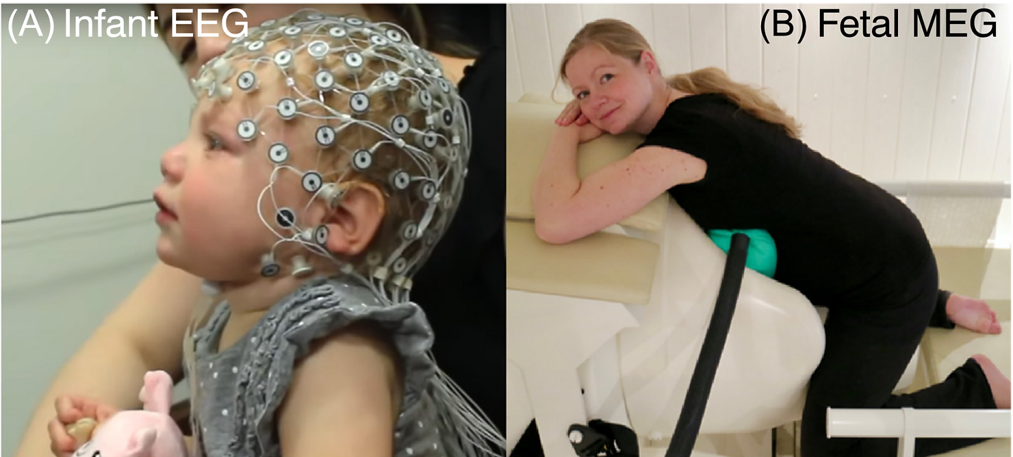 Examples of techniques for recording brain activity and/or neuroimaging in infants and fetuses. Infant electroencephalography (EEG) with a geodesic electrode net (laboratory of Shafali Jeste). Fetal magnetoencephalography (MEG) recorded from a pregnant woman (University Hospital Tübingen). 