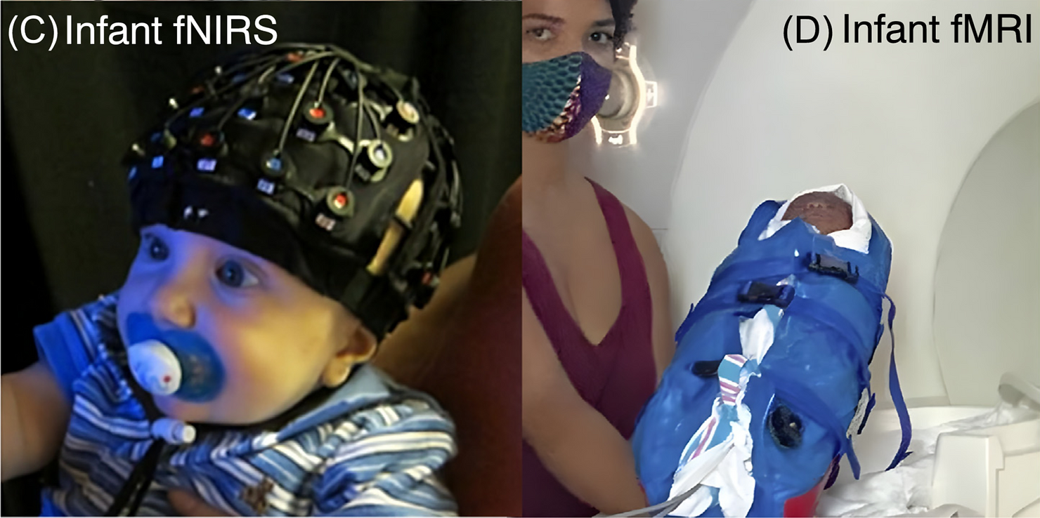 Infant functional near infrared spectroscopy (fNIRS) recording with multichannel optodecap (AIupscaled from [133]). An infant is prepared for functional magnetic resonance imaging (fMRI) (AI upscaled from [137]). Abbreviation: AI, artificial intelligence.