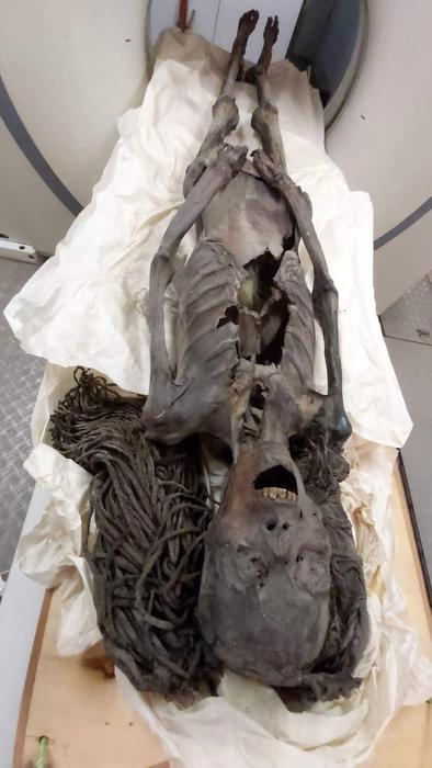 The Screaming Woman in the CT scan

