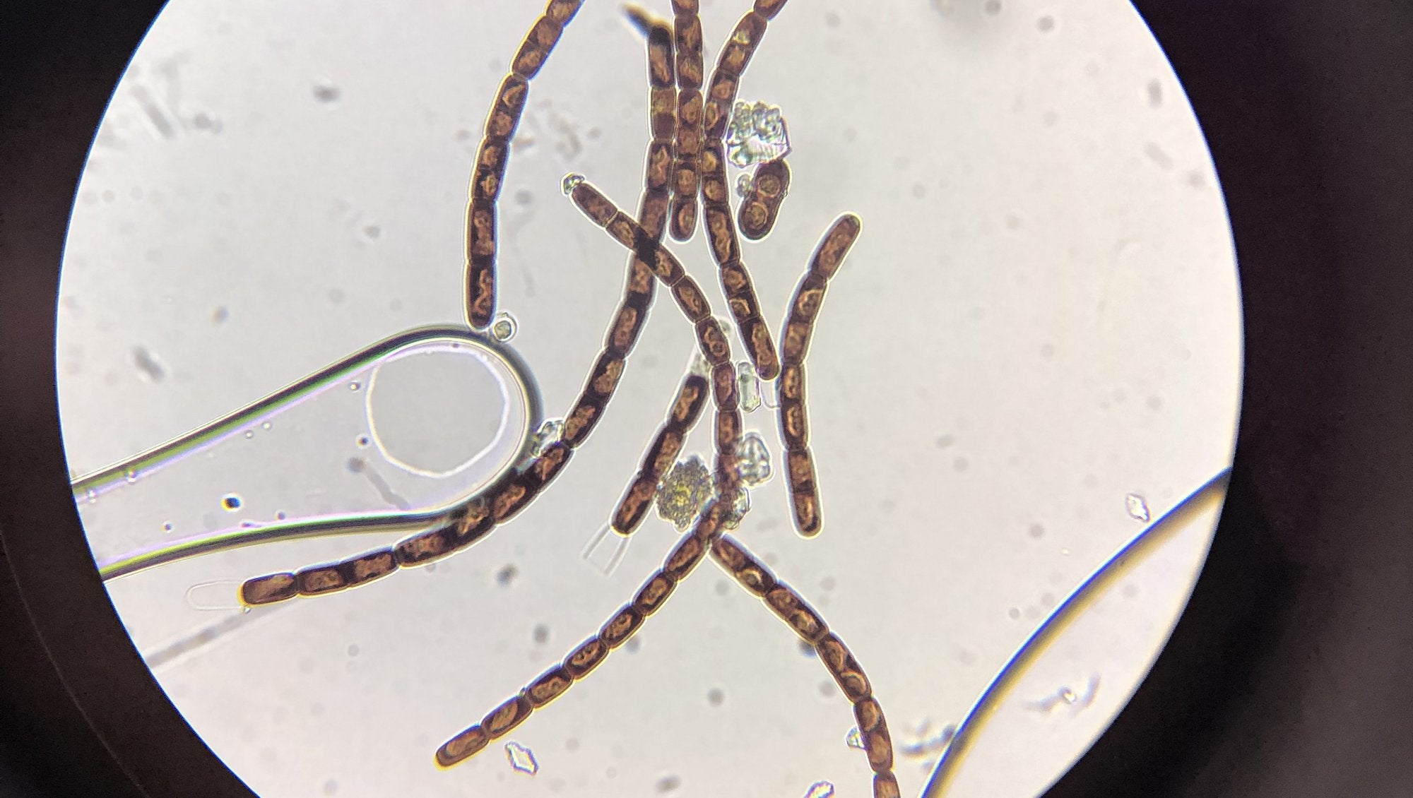 Laura Perini hasn't seen a giant virus in the microscope yet. But it's not impossible. Here it's some of the other microorganisms from Greenland.