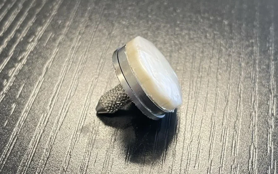 A hydrogel-based implant could replace worn-out cartilage and alleviate knee pain without replacing the entire joint. 