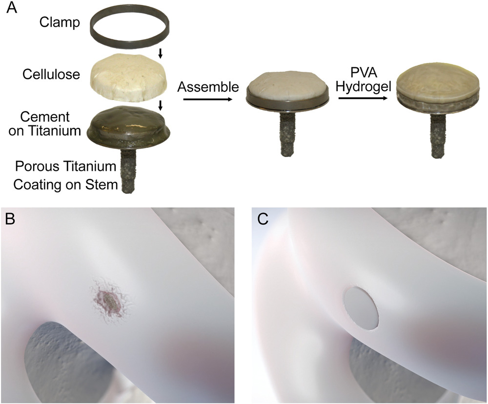 A Synthetic Hydrogel Composite with a Strength and Wear Resistance Greater than Cartilage. 