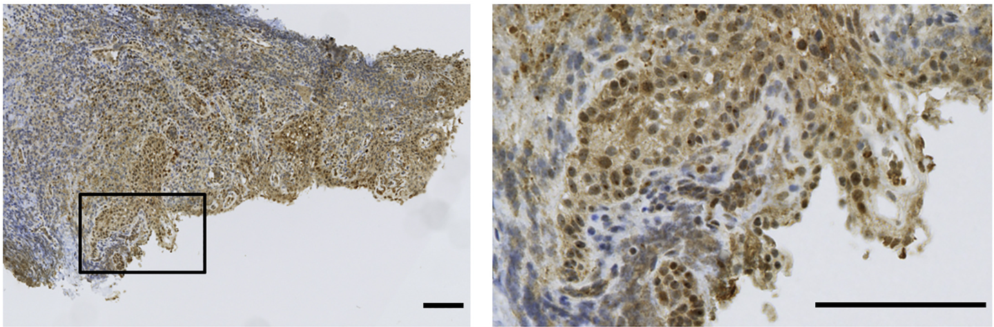 Immunohistochemistry of human SUCNR1 staining (brown) in human gingival tissue (scale bar, 100 μm).