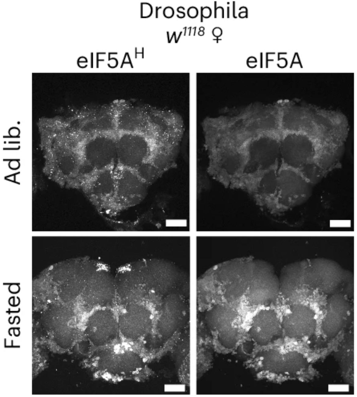Hypusination of eIF5A acts downstream of spermidine to mediate IF-associated longevity.