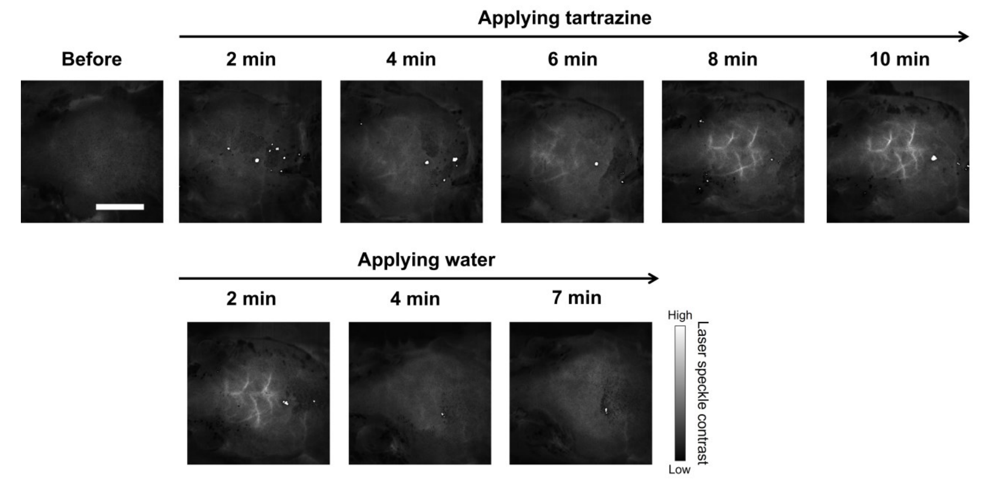 Repeated optical transparency and reversion can be achieved by applying tartrazine and water sequentially to the mouse scalp, as evidenced by the appearance and disappearance of cerebral blood vessels in the laser speckle contrast images.