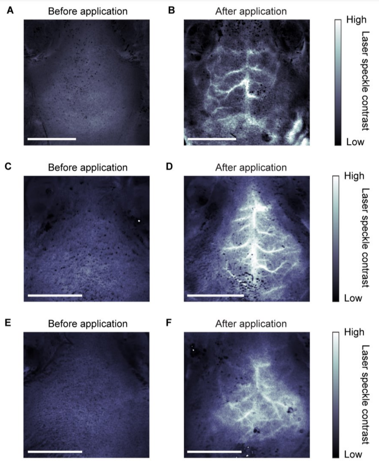 Generalizability of the Lorentz model in guiding the selection of dye molecules for achieving in vivo optical transparency.