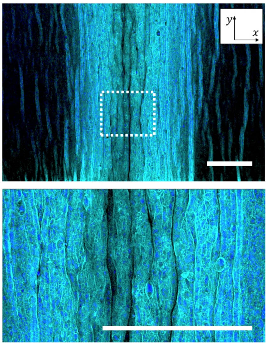 Immunofluorescence image showing a moment when wrinkle patterns hierarchically changed to a fold pattern and corresponding magnified image. Caco-2 epithelium of the epithelial bilayer was labeled with phalloidin (cyan) and DAPI (blue).