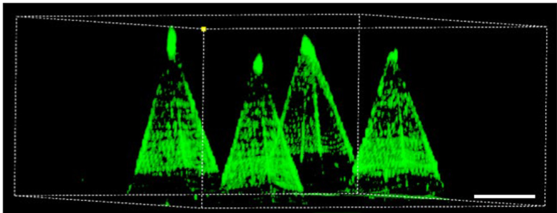 Fluorescence microscopy image of the Ce-MNs patch containing FITC-labeled CeNZs. Scale bar = 200 μm.