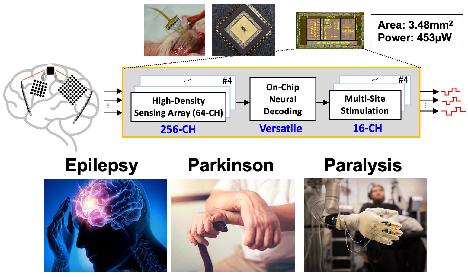 The SoC is versatile and can be used in different applications including epilepsy, movement disorders, and motor decoding in BCIs.
