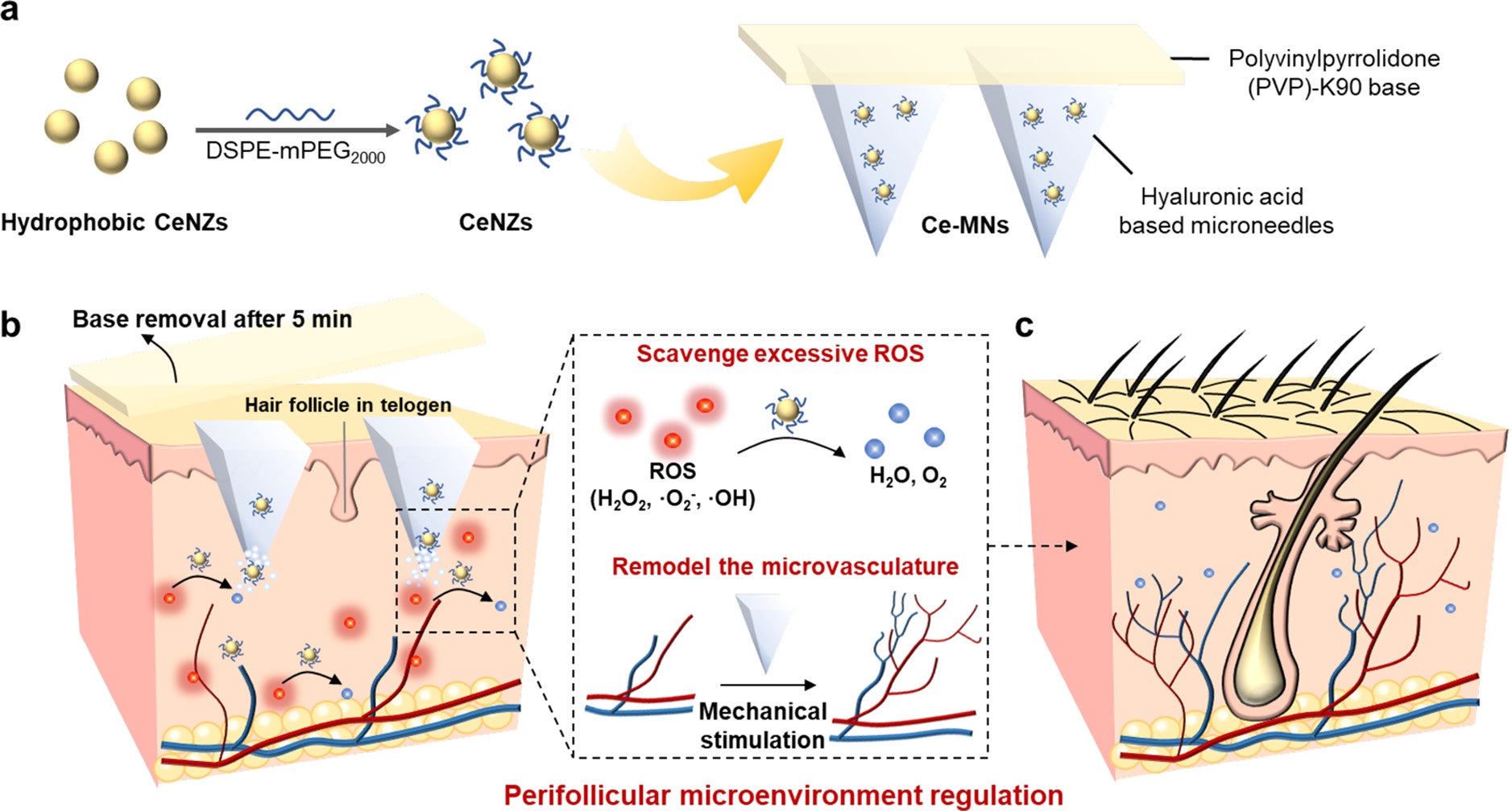 Schematic illustration of androgenetic alopecia (AGA) therapy through a ceria nanozyme (CeNZ)-integrated microneedles (Ce-MNs) patch.