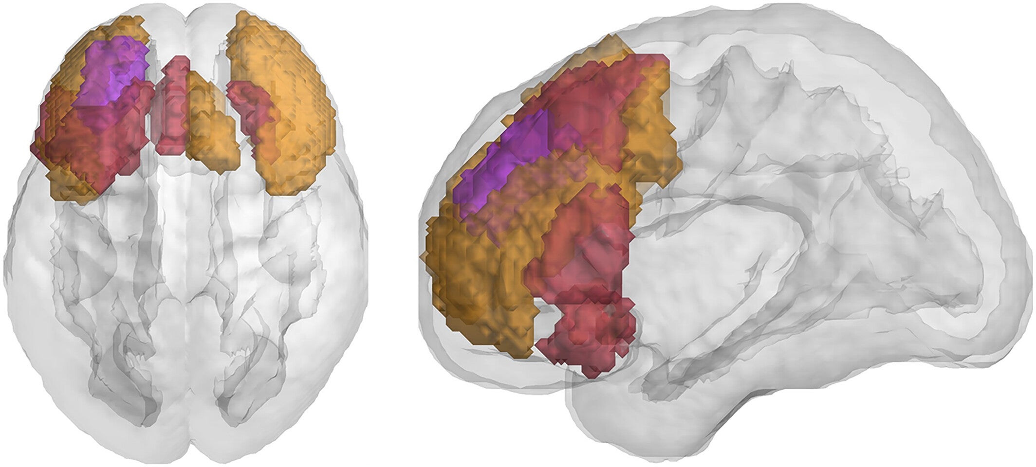 Functional regions included in the Lateral PFC connectivity map, colored by intrinsic connectivity network. Purple, ventral attention; orange, frontoparietal; red, default mode