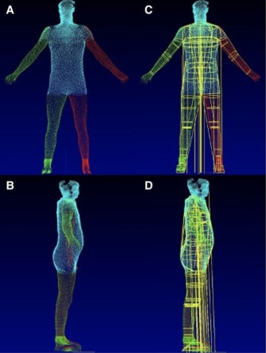 (A) Front-facing and (B) side-facing images taken by the multisensor white-light 3D body volume scanner (Select Research). (C and D) Post-processing of images used to estimate and derive body volumes.