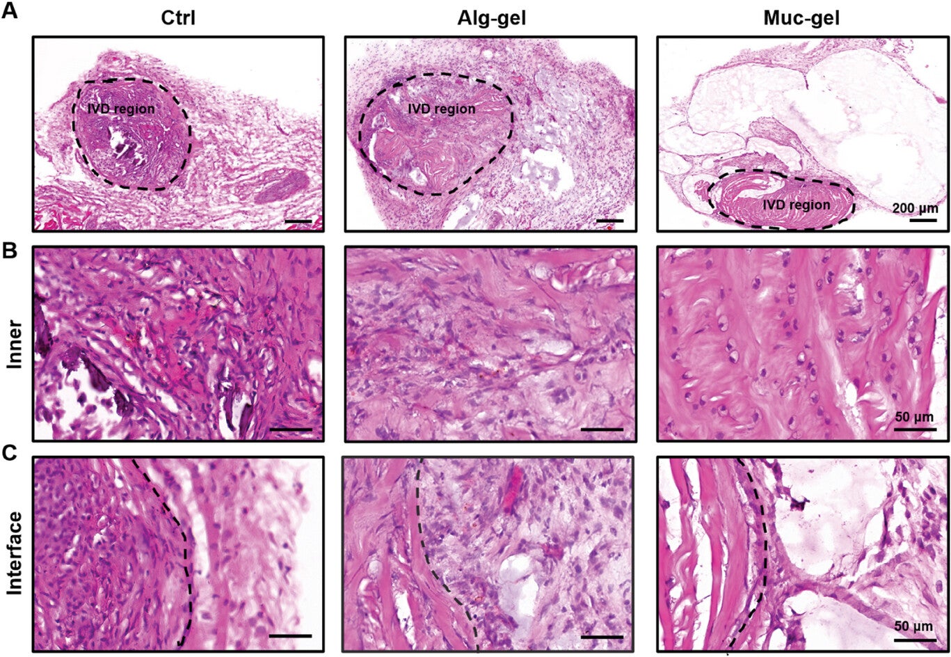 Tissue in-growth in gel-encapsulated IVDs, and non-encapsulated IVDs in a mouse subcutaneous model at week 2 are investigated using HE staining A). Representative images of the internal IVD region B) and the interface between the IVD region and external tissues C).