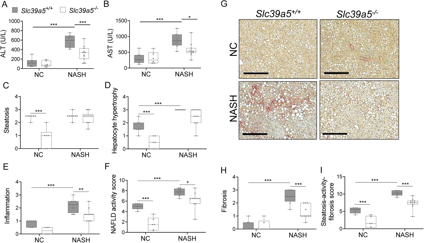 Loss of Slc39a5 improves hepatic inflammation and fibrosis in female mice challenged with diet-induced NASH.
