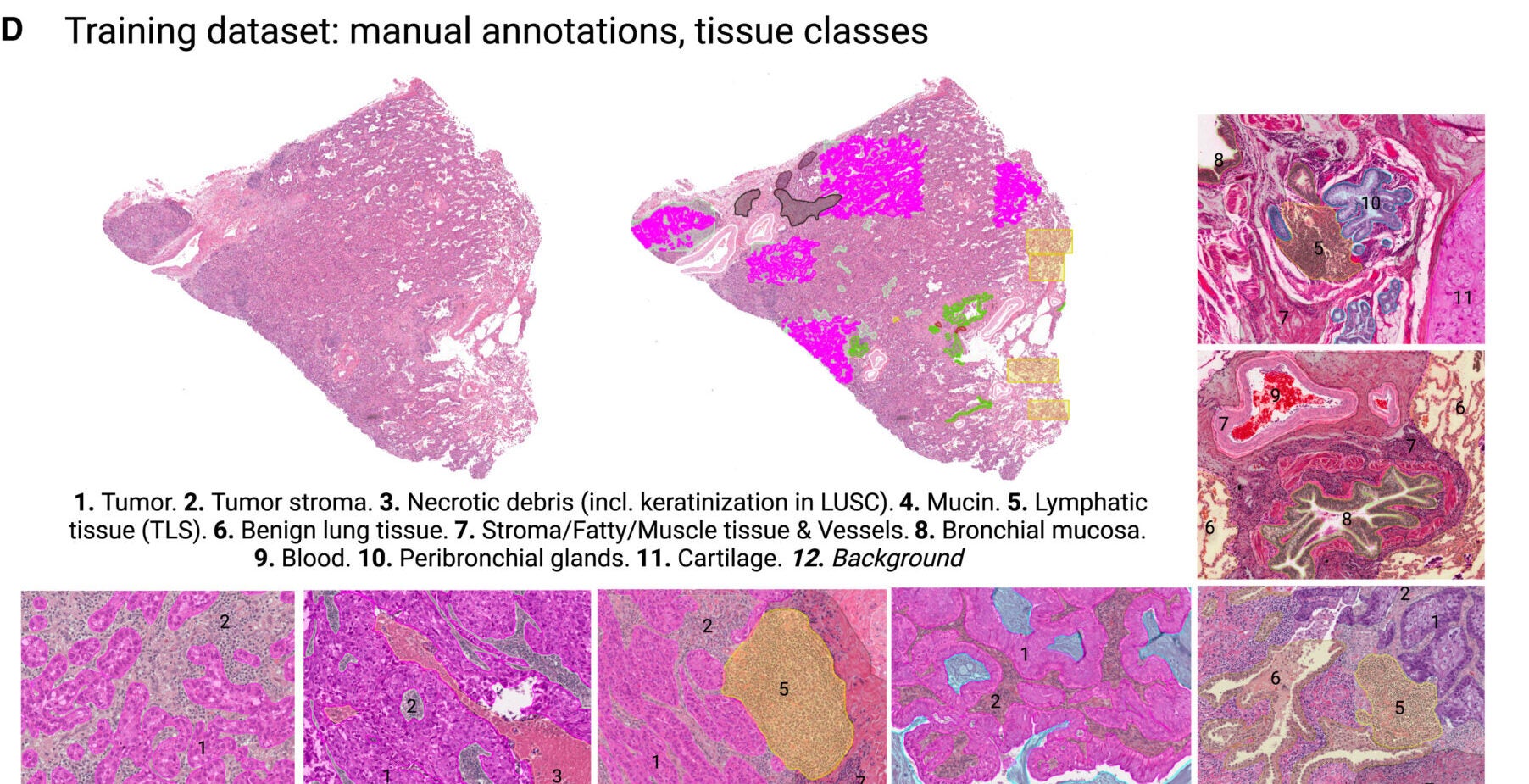 Principles of high-precision, extensive manual annotations with representative examples of 11 tissue classes are presented. The figure was prepared with BioRender.