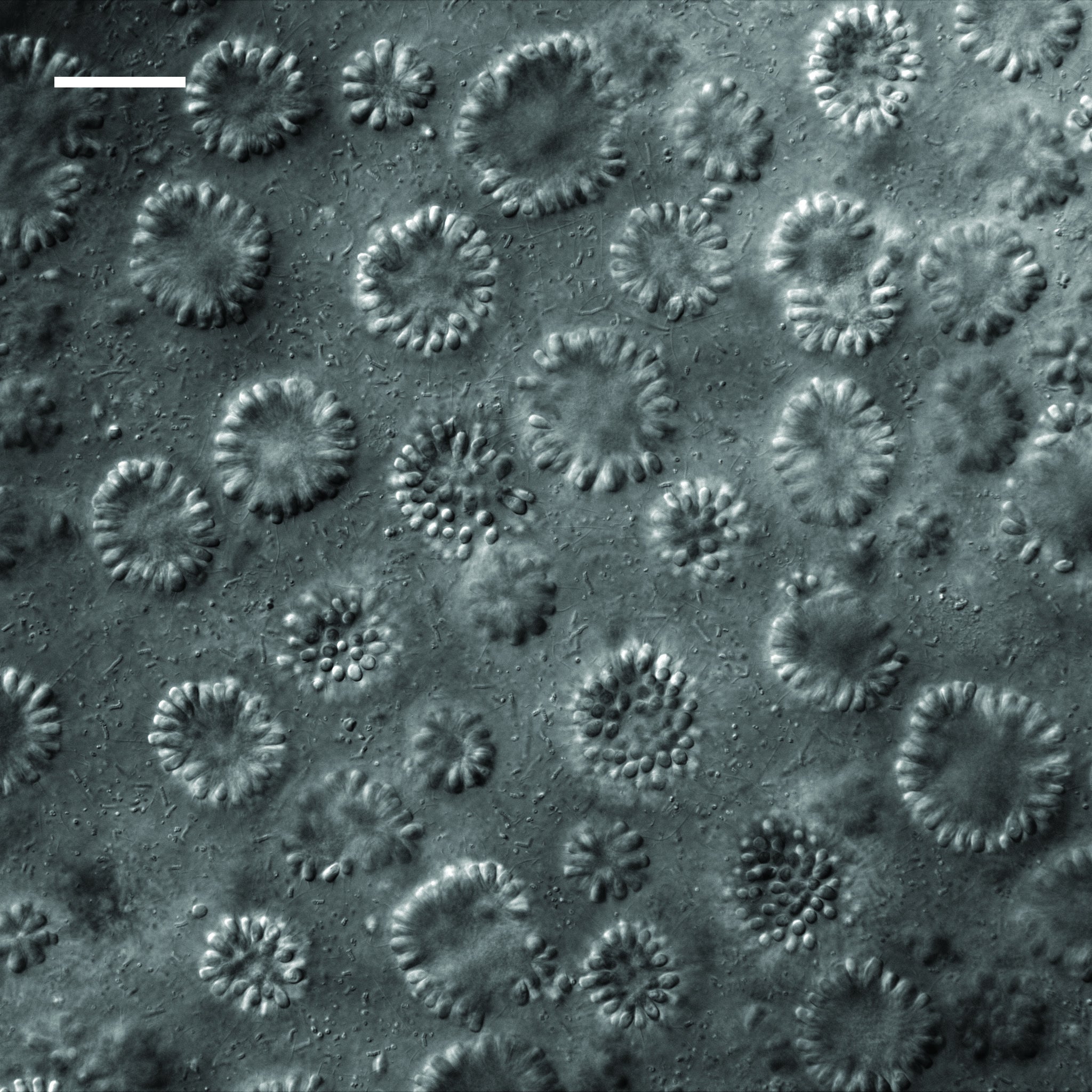 Globular colonies of the choanoflagellate B. monosierra seen under a microscope. As indicated by the 50-micron scale bar, these colonies are at the limit of what’s visible to the naked eye.