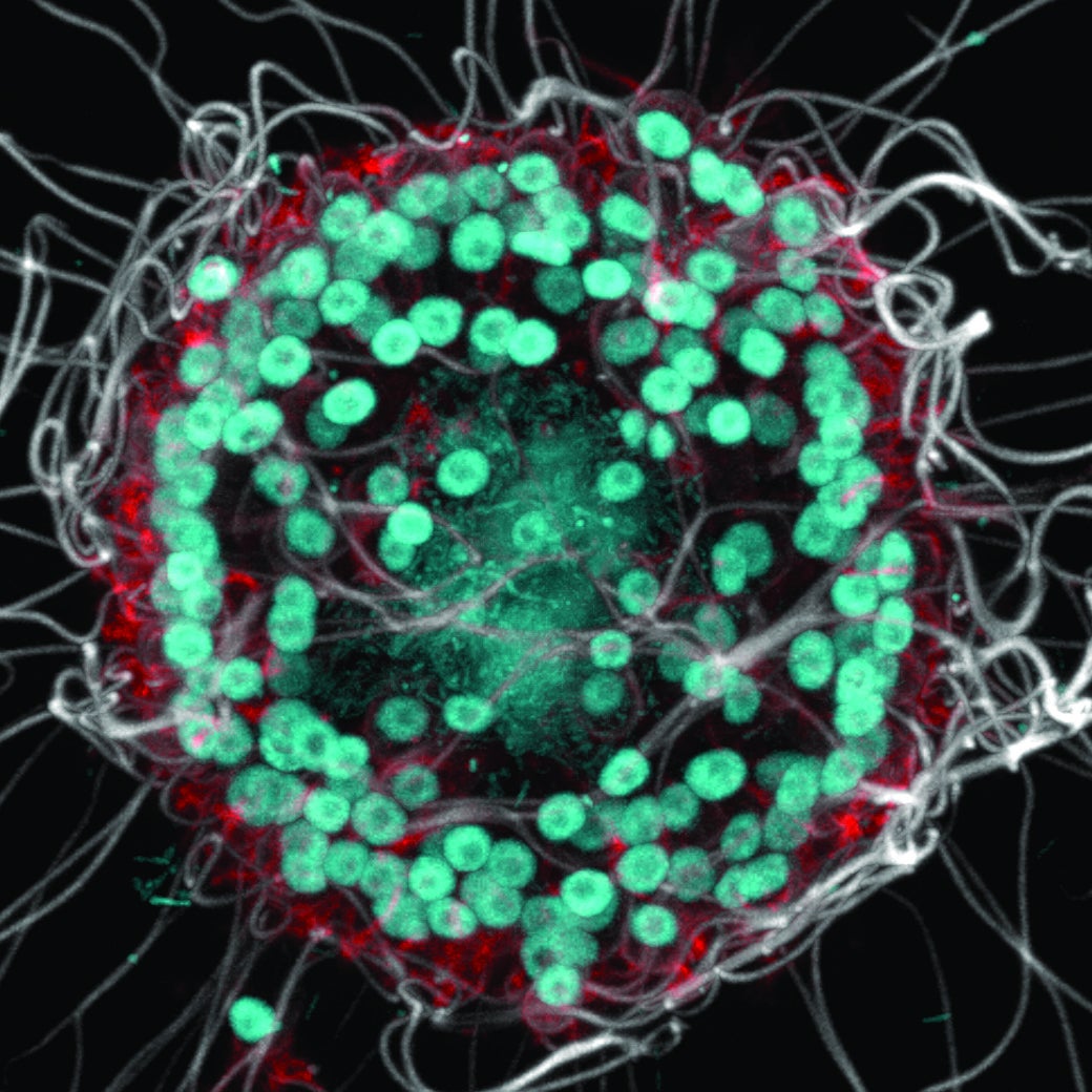A colony of choanoflagellates stained to show its features. Cyan indicates DNA — the doughnut-shaped DNA of the choanoflagellate cells and a cloud of bacterial DNA inside the colony — while flagella are white and microscopic hairs (villi) on each cell are red.