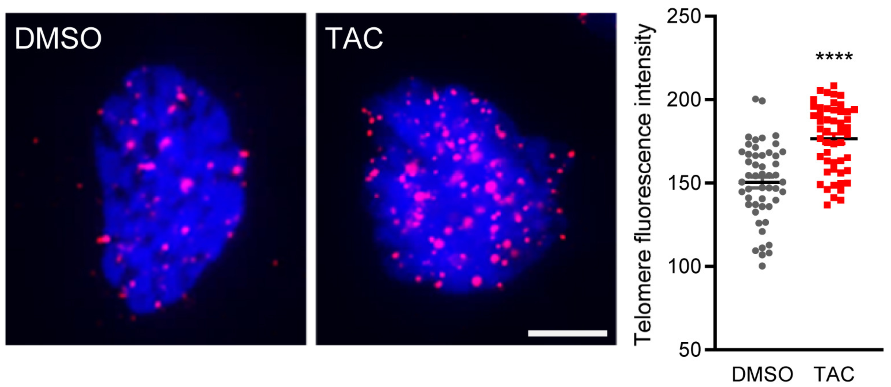 Relative telomere length of primary WS fibroblasts treated with vehicle or TAC. Relative telomere length was determined as the ratio of telomere repeat copy numbers to single copy gene 36B4 copy number measured by quantitative PCR (n = 4 per group, two-tailed unpaired t test).