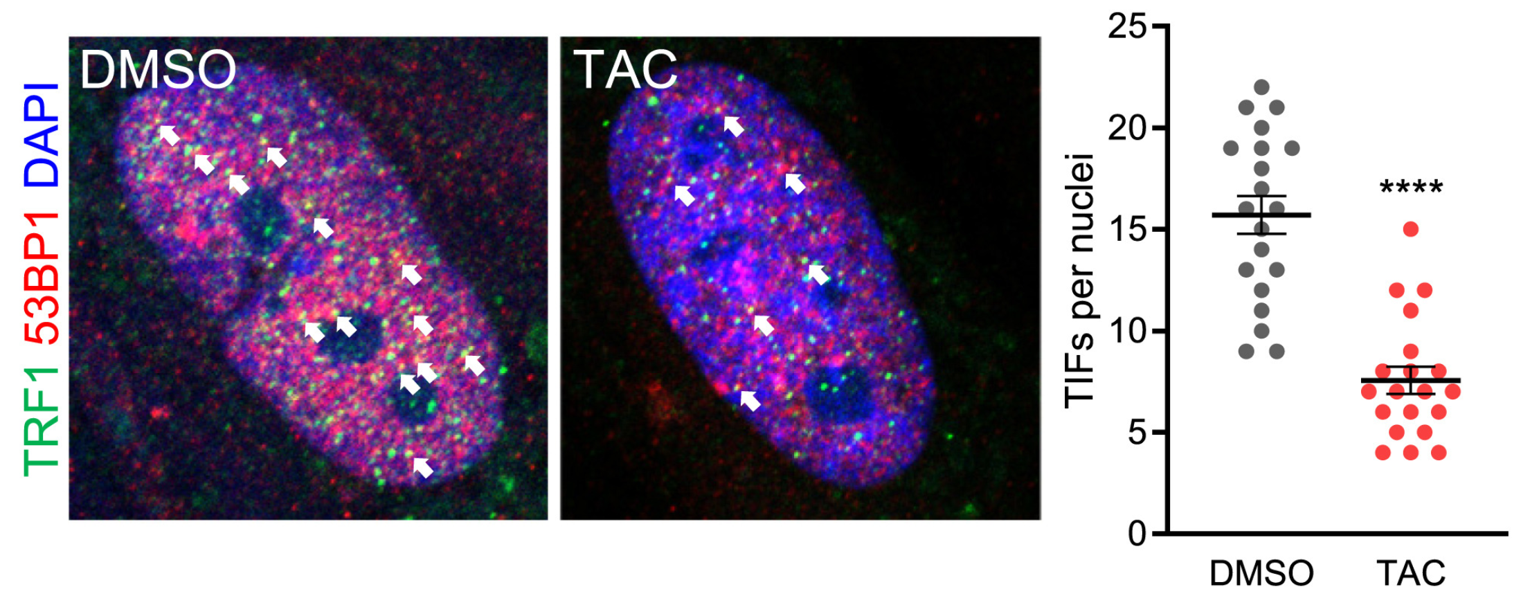 Left, representative images of confocal sections of TIFs in nuclei of WS fibroblasts treated with vehicle or TAC for 3 months. Right, quantification of TIFs in nuclei of vehicle- or TAC-treated WS fibroblasts (n = 20 nuclei per group, two-tailed unpaired t test).
