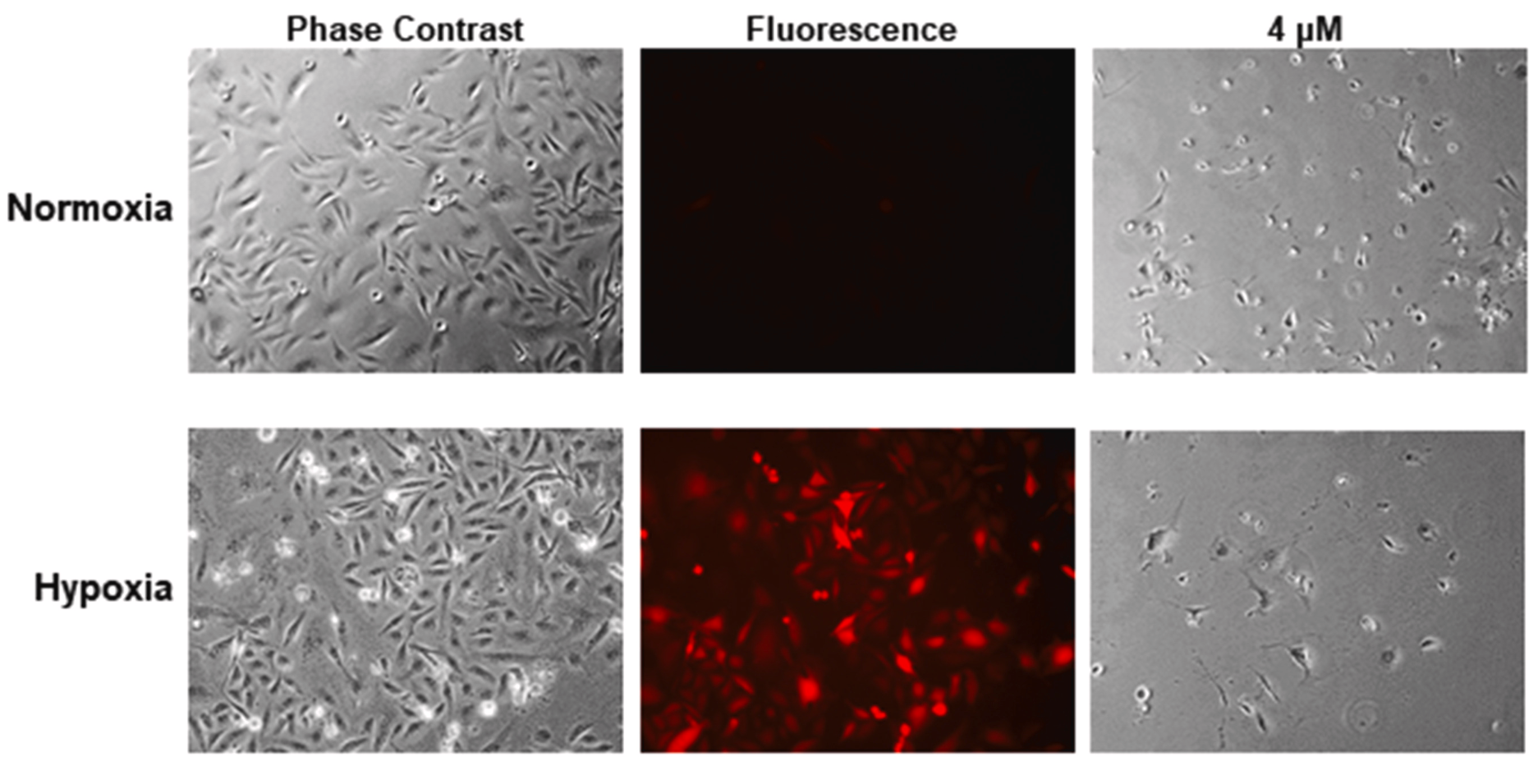 Evaluation of RK-33's efficacy under hypoxic conditions and its effect on endothelia growth and vessel-like formation. Phase contrast and fluorescence images of 231-tdT cells cultured in normoxic (top panels) or hypoxic (lower panels) conditions with and without the addition of 4 μM RK-33.