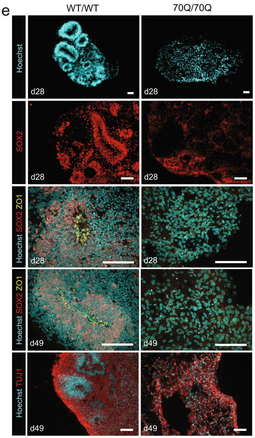 Immunostaining in cerebral organoids at day 28 and 49 showing defective cytoarchitecture and neural progenitor cell (NPC) organization in 70/70Q. Data were repeated in three independent experiments. Scale bar: 100 µm. 