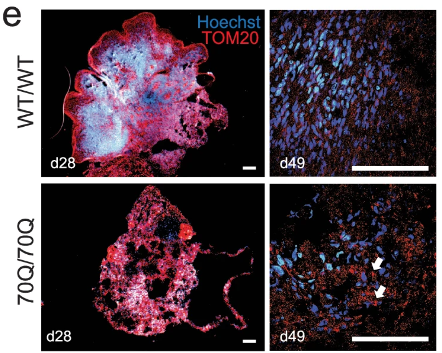 Representative immunostaining and related quantification of mitochondrial footprint (comprising both small and large mitochondrial structures) based on TOM20 signal in cerebral organoids from 70Q/70Q and WT/WT.