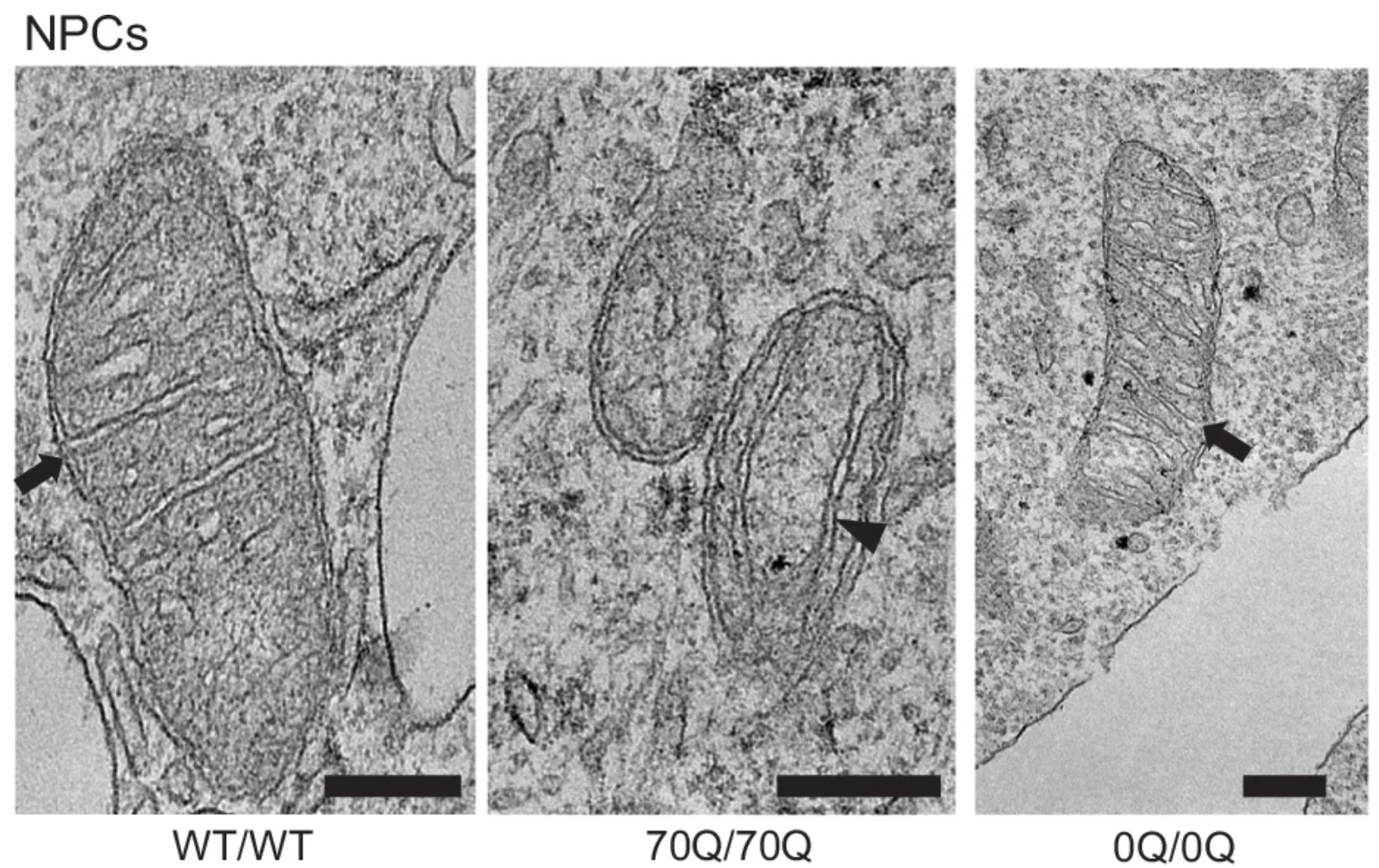 Representative electron microscopy images of mitochondria within WT/WT NPCs, 70Q/70Q NPCs, and 0Q/0Q NPCs. Arrows indicate mitochondrial cristae with transverse direction with respect to mitochondrial outer membrane. Arrowhead indicates cristae with longitudinal direction. Data were repeated in two independent experiments. 