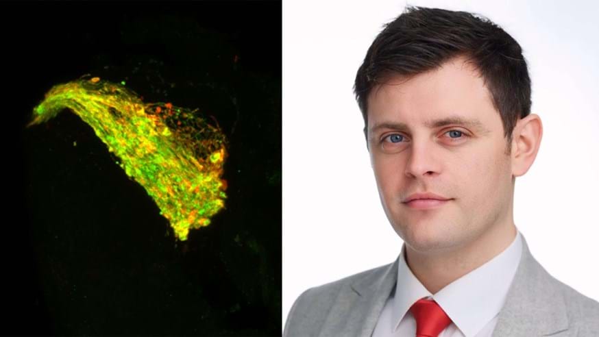 Dr Anthony Aggidis and the brain of a fruit fly with Tau expressed in a neuronal circuit used by the fly in olfactory memory. The red shows where Tau is building up in clusters along the neurons