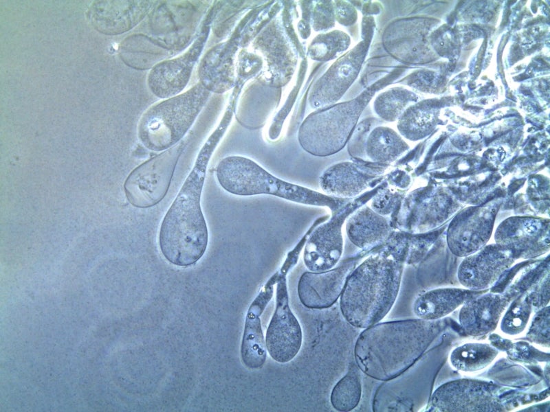 Image magnified a thousand times shows nutritive vesicles (gongylids) produced by the fungus Leucoagaricus gongylophorus, cultivated by the lemon leafcutter (Atta sexdens).