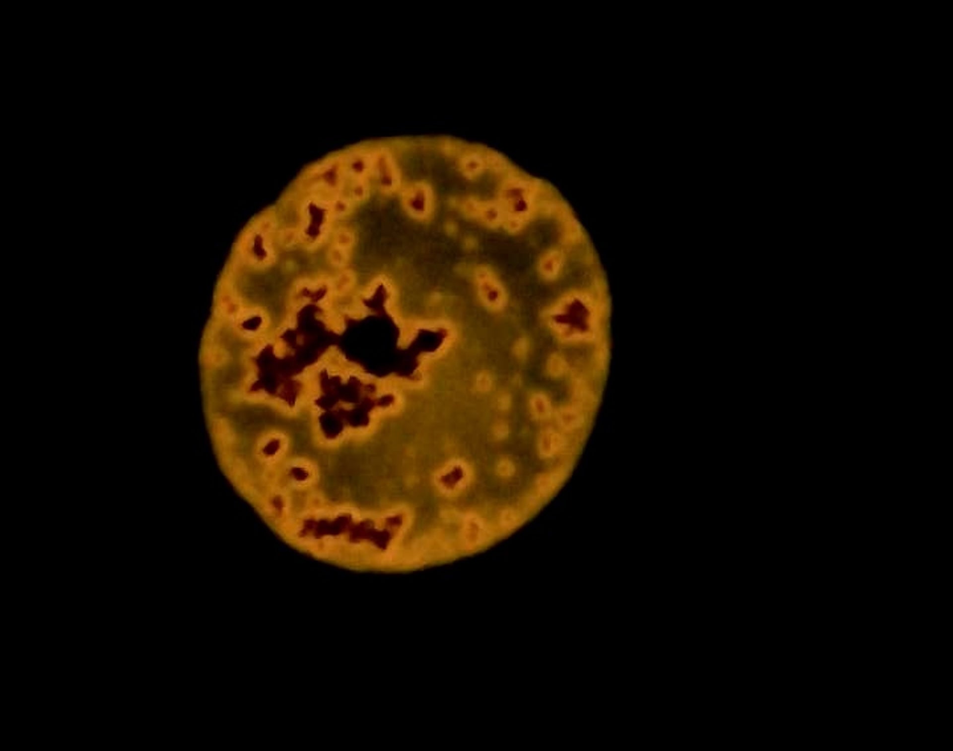 Micro- and nanoplastics particles under the microscope.