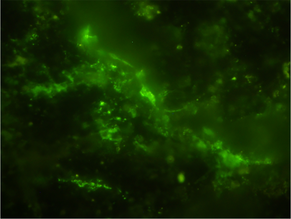 This picture shows many tiny cells in which DNA is abundantly included inside the cells. The microbial cells were detected in fractures in the rock sample using an infrared imaging technique called O-PTIR spectroscopy.