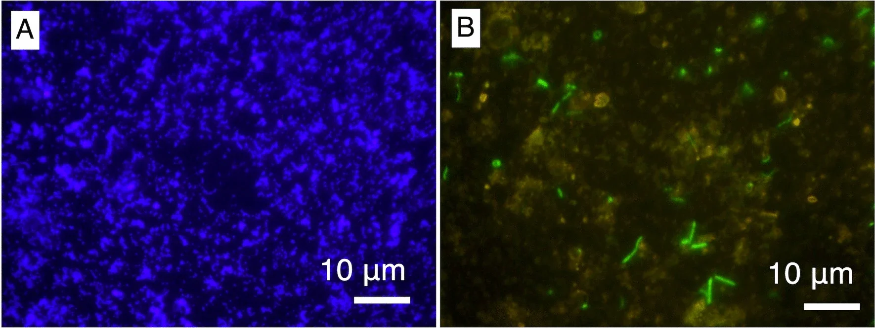 Microscopic inspection of the drill fluid sample. A 1000-fold magnification images of fluorescent microspheres and (B) microbial cells stained by SYBR Green I