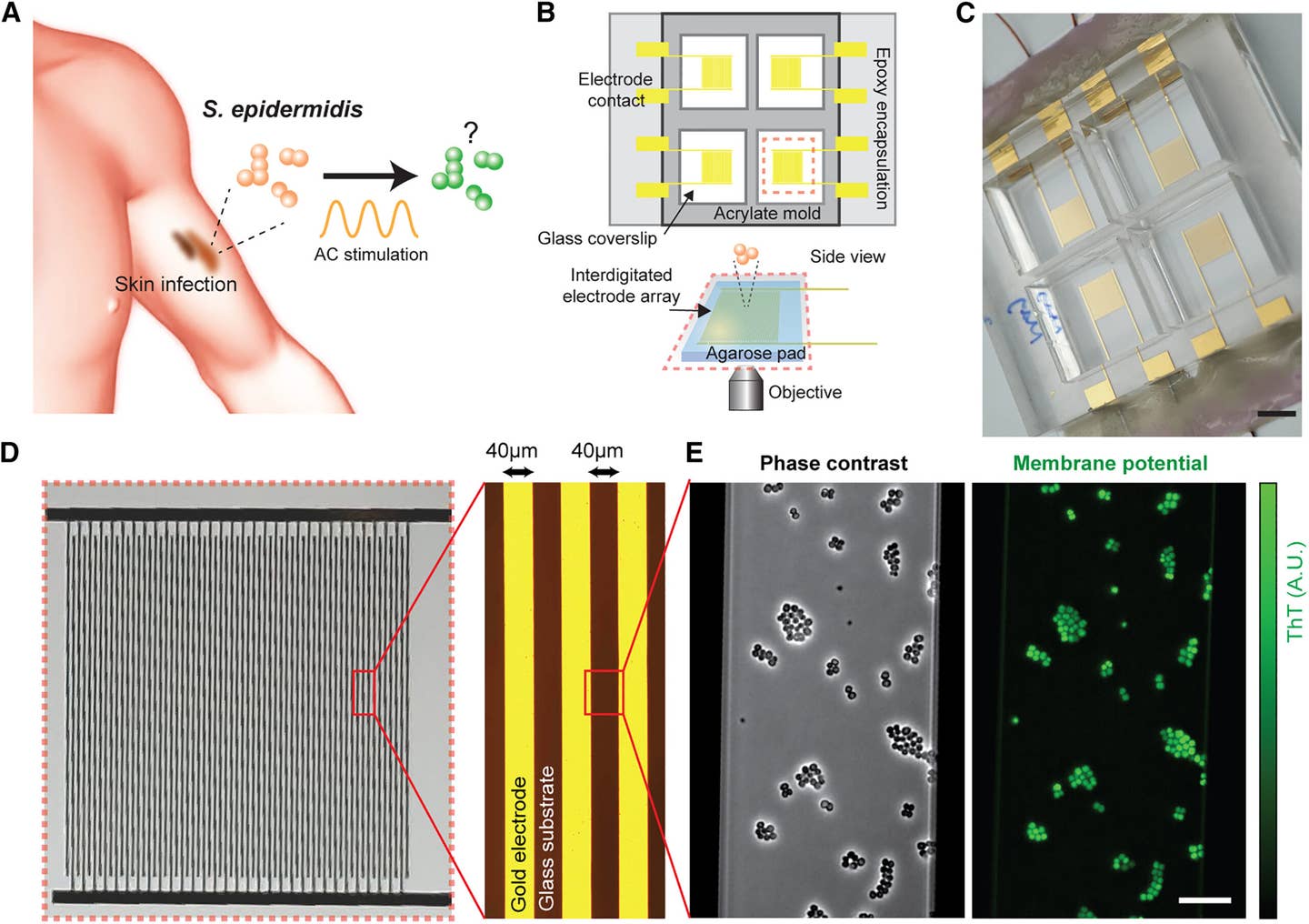Groundbreaking bioelectronic device fights infections without ...