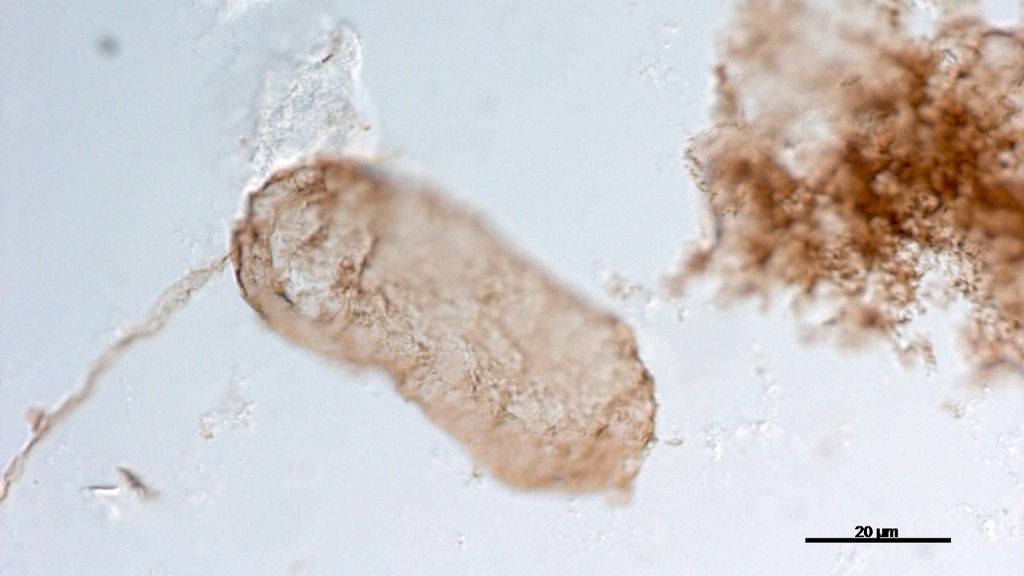 Image of Navifusa majensis, a microfossil from the McDermott Formation in Australia. This 1.75 billion-year-old microfossil contains thylakoids, which identify it as a cyanobacterium. 