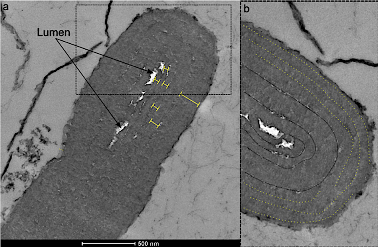 TEM pictures of a specimen of Navifusa majensis, from the Grassy Bay Formation (Shaler Supergroup, Canada).